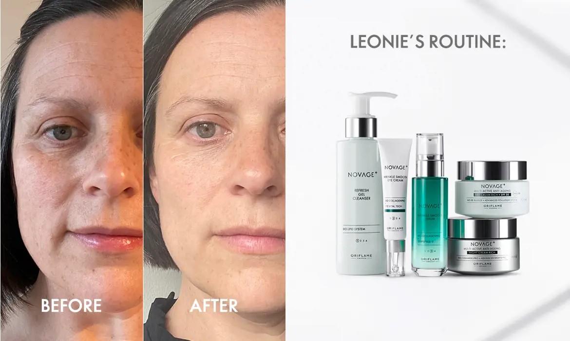 " Moje pleť se cítí zdravěji." Leona, 43